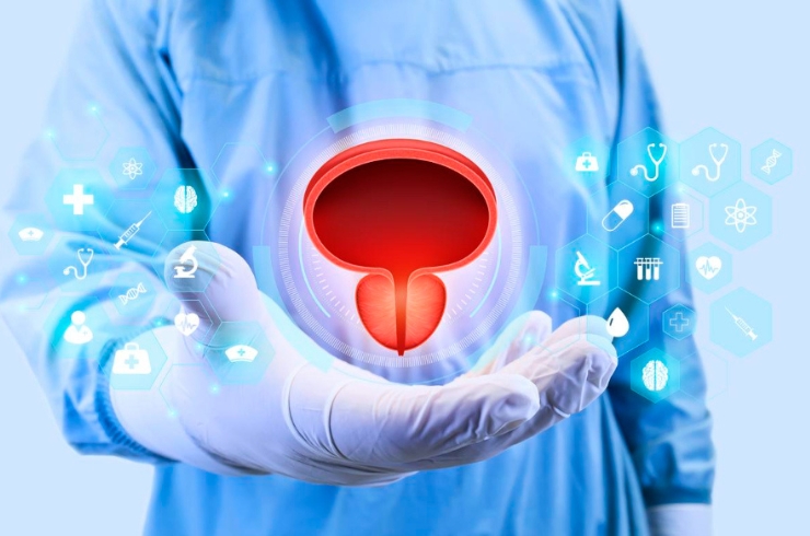 Bladder Cancer