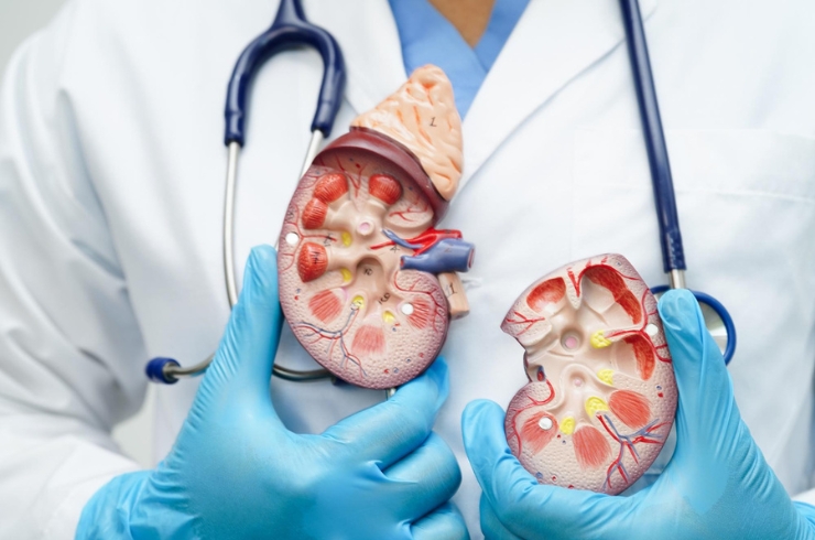 Hydronephrosis