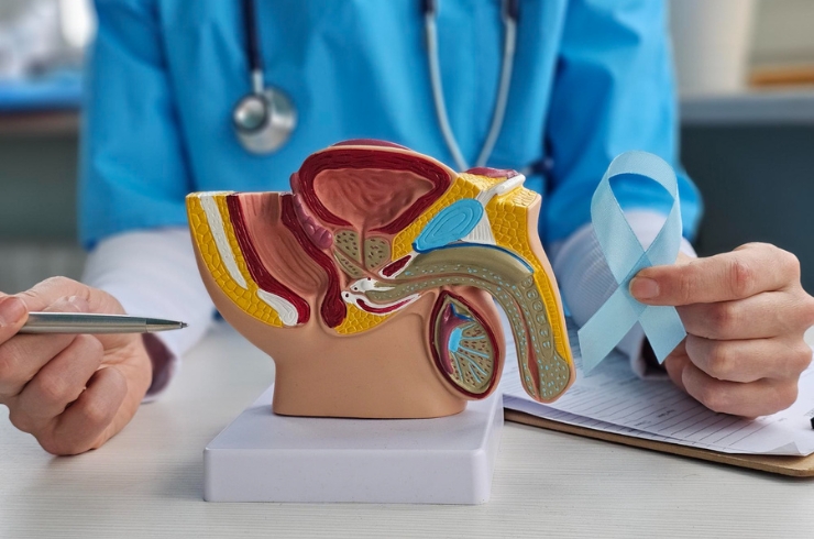 Prostate Cancer